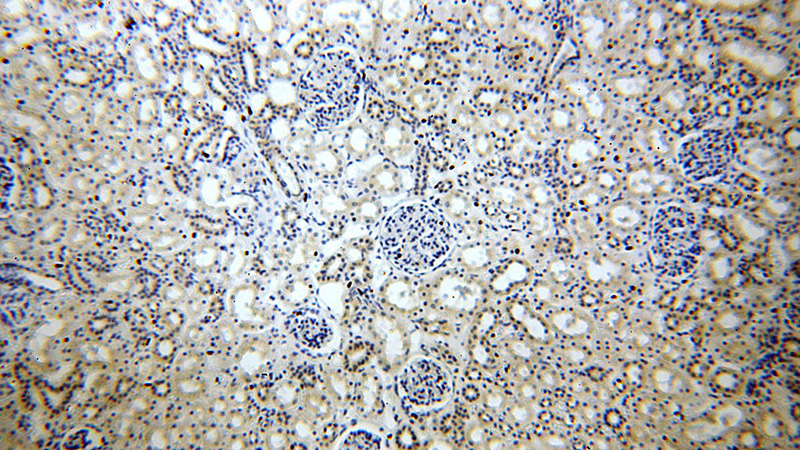 Immunohistochemical of paraffin-embedded human kidney using Catalog No:117259(ZO1 antibody) at dilution of 1:100 (under 10x lens)