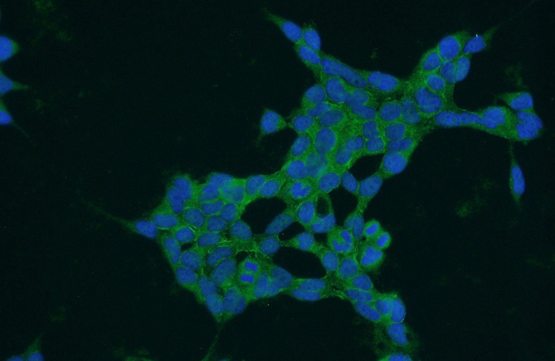 Immunofluorescent analysis of HEK-293 cells using Catalog No:113501(PAK6 Antibody) at dilution of 1:50 and Alexa Fluor 488-congugated AffiniPure Goat Anti-Rabbit IgG(H+L)