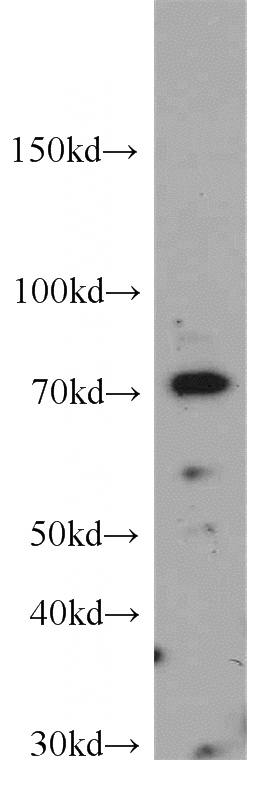 COLO 320 cells were subjected to SDS PAGE followed by western blot with Catalog No:115548(SPATA13 antibody) at dilution of 1:300