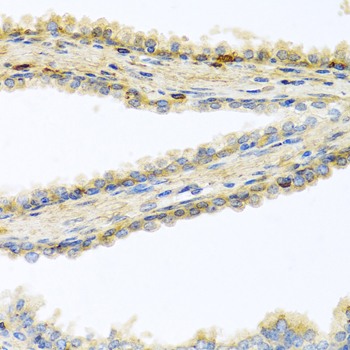 Immunohistochemistry - GPLD1 Polyclonal Antibody 