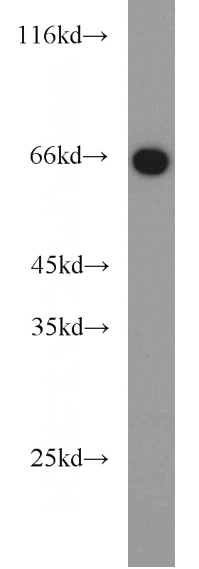 NIH/3T3 cells were subjected to SDS PAGE followed by western blot with Catalog No:113796(PGT antibody) at dilution of 1:1000