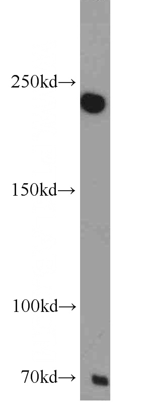 mouse liver tissue were subjected to SDS PAGE followed by western blot with Catalog No:112442(MAPKBP1 antibody) at dilution of 1:500
