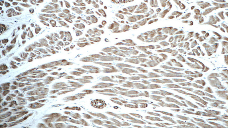 Immunohistochemistry of paraffin-embedded human heart tissue slide using Catalog No:107838(AGTR1 Antibody) at dilution of 1:50 (under 10x lens)