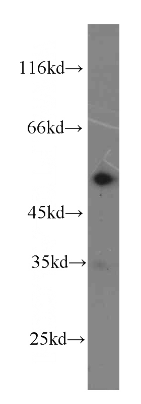 Jurkat cells were subjected to SDS PAGE followed by western blot with Catalog No:107409(LYN antibody) at dilution of 1:1000