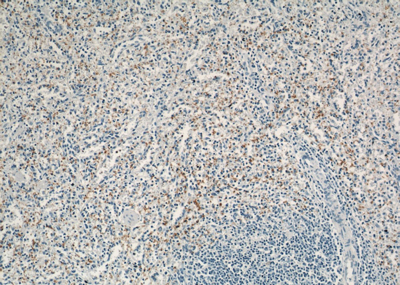 Immunohistochemical of paraffin-embedded human spleen using Catalog No:109122(GP1BA antibody) at dilution of 1:50 (under 10x lens)
