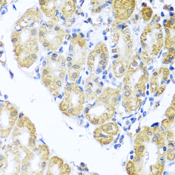 Immunohistochemistry - BNIP3L Polyclonal Antibody 