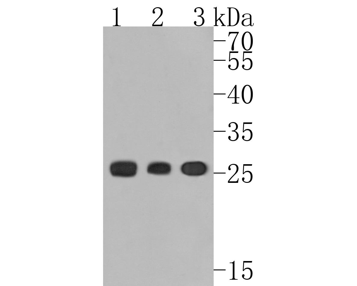 Fig1:; Western blot analysis of Human Kappa light chain on different lysates. Proteins were transferred to a PVDF membrane and blocked with 5% BSA in PBS for 1 hour at room temperature. The primary antibody ( 1/500) was used in 5% BSA at room temperature for 2 hours. Goat Anti-Rabbit IgG - HRP Secondary Antibody (HA1001) at 1:5,000 dilution was used for 1 hour at room temperature.; Positive control:; Lane 1: Human spleen tissue lysate; Lane 2: Human thymus tissue lysate; Lane 3: Human plasma tissue lysate