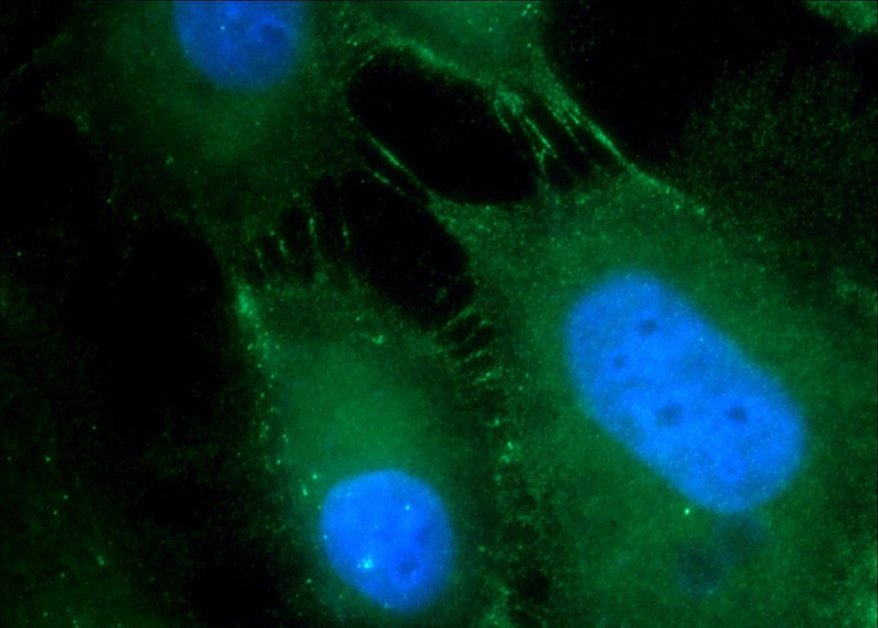 Immunofluorescent analysis of A431 cells using Catalog No:110027(DSG2 Antibody) at dilution of 1:25 and Alexa Fluor 488-congugated AffiniPure Goat Anti-Rabbit IgG(H+L)