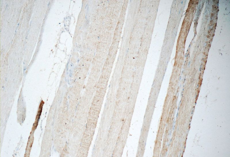 Immunohistochemistry of paraffin-embedded human skeletal muscle tissue slide using Catalog No:109277(CHRNA1 Antibody) at dilution of 1:50 (under 10x lens)