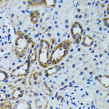 Immunohistochemistry - RPN1 Polyclonal Antibody 