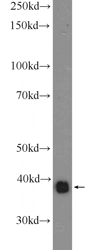 K-562 cells were subjected to SDS PAGE followed by western blot with Catalog No:110182(EIF2B2 Antibody) at dilution of 1:1000