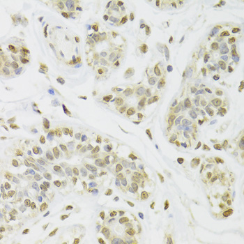 Immunohistochemistry - DOK1 Polyclonal Antibody 