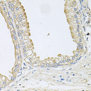 Immunohistochemistry - ANKH Polyclonal Antibody 