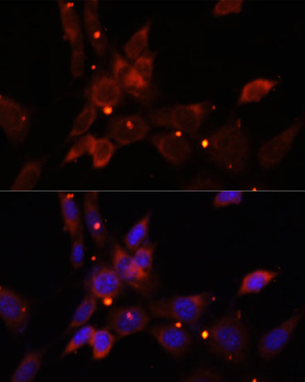 Immunofluorescence - IKBKE Polyclonal Antibody 