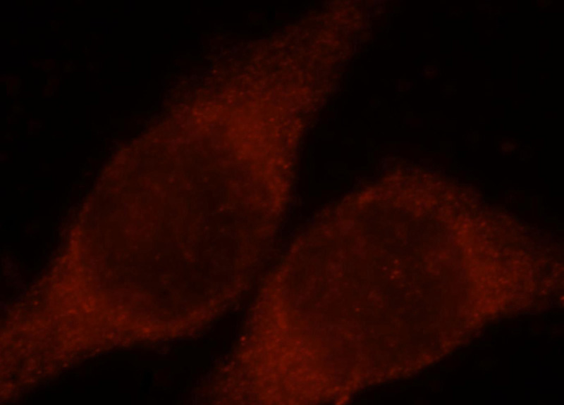 Immunofluorescent analysis of MCF-7 cells, using CLIC3 antibody Catalog No:109389 at 1:25 dilution and Rhodamine-labeled goat anti-rabbit IgG (red).