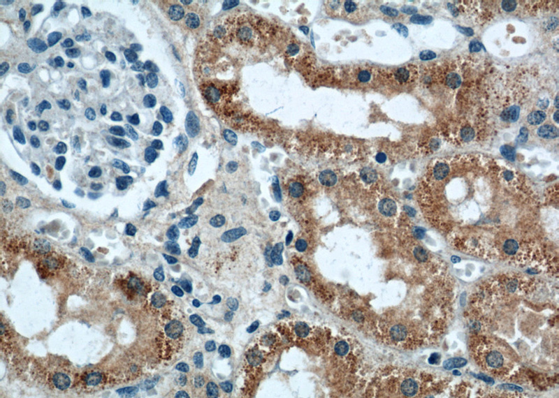 Immunohistochemical of paraffin-embedded human kidney using Catalog No:107278(IFT88 antibody) at dilution of 1:50 (under 40x lens)