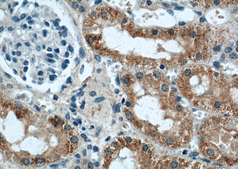 Immunohistochemical of paraffin-embedded human kidney using Catalog No:107278(IFT88 antibody) at dilution of 1:50 (under 40x lens)