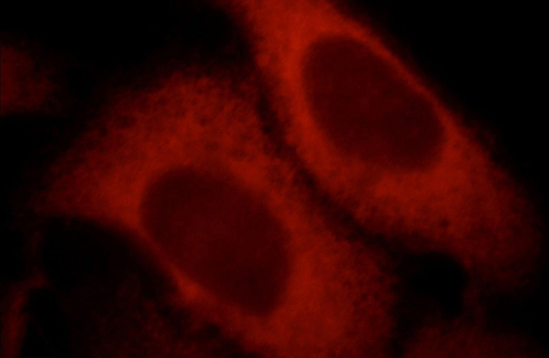 Immunofluorescent analysis of HepG2 cells, using RocK2 antibody Catalog No:114779 at 1:25 dilution and Rhodamine-labeled goat anti-rabbit IgG (red).