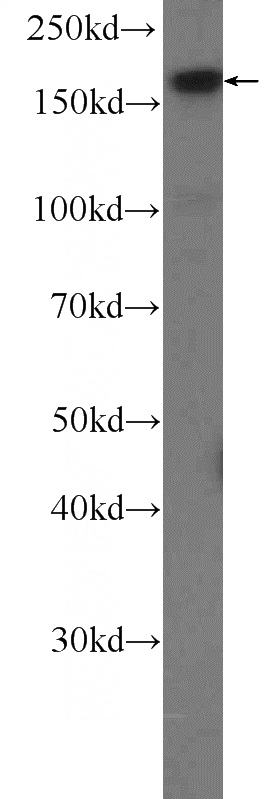 Jurkat cells were subjected to SDS PAGE followed by western blot with Catalog No:116595(USP19 Antibody) at dilution of 1:600