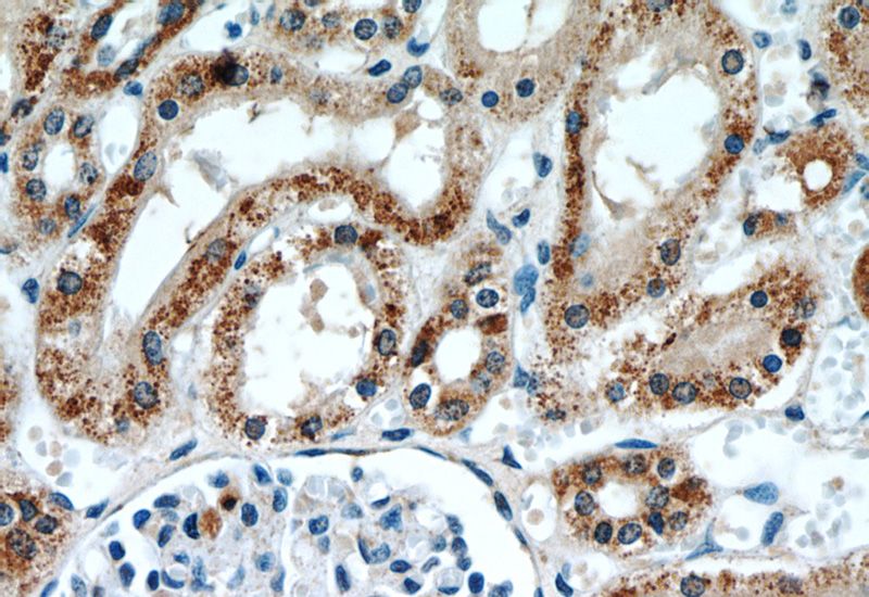 Immunohistochemistry of paraffin-embedded human kidney slide using Catalog No:108106(SLC25A5 Antibody) at dilution of 1:50
