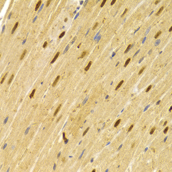 Immunohistochemistry - CDC25A Polyclonal Antibody 