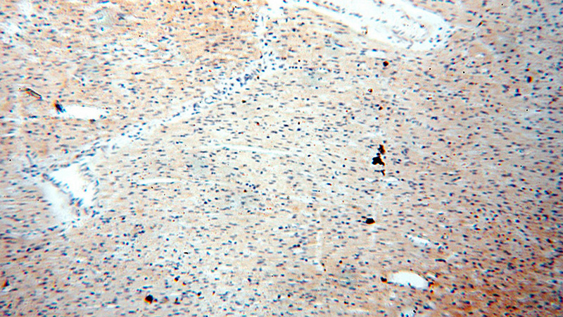 Immunohistochemical of paraffin-embedded human heart using Catalog No:115163(SGCG antibody) at dilution of 1:50 (under 10x lens)