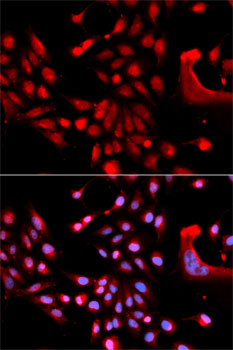 Immunofluorescence - U2AF1 Polyclonal Antibody 