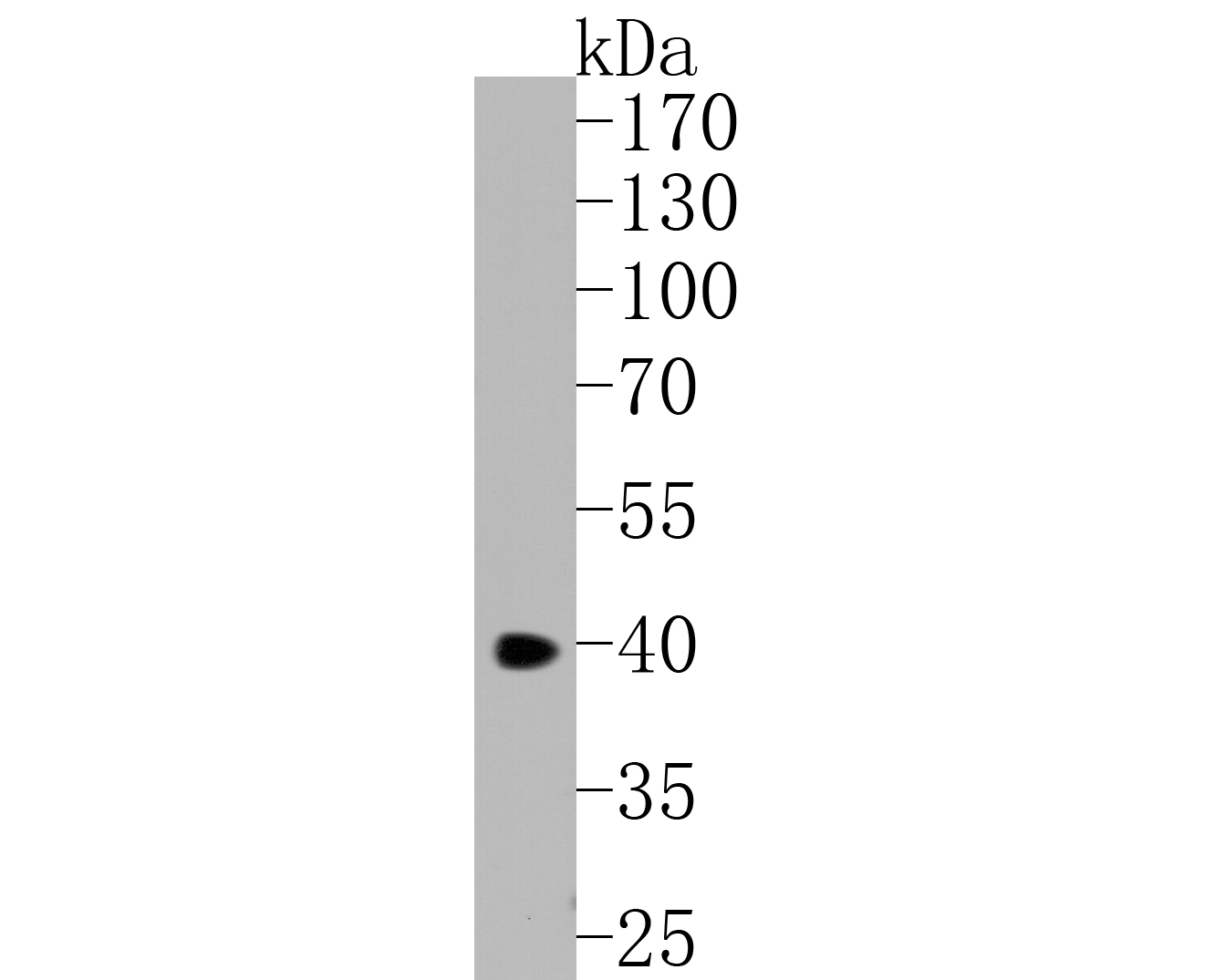 Fig1:; Western blot analysis of YKL-40 on THP-1 cell lysates. Proteins were transferred to a PVDF membrane and blocked with 5% NFTM/TBST for 1 hour at room temperature. The primary antibody ( 1/500) was used in 5% NFTM/TBST at room temperature for 2 hours. Goat Anti-Mouse IgG - HRP Secondary Antibody (HA1006) at 1:5,000 dilution was used for 1 hour at room temperature.