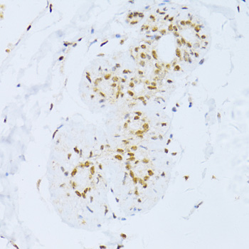 Immunohistochemistry - ZEB2 Polyclonal Antibody 