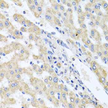 Immunohistochemistry - ITPKB Polyclonal Antibody 