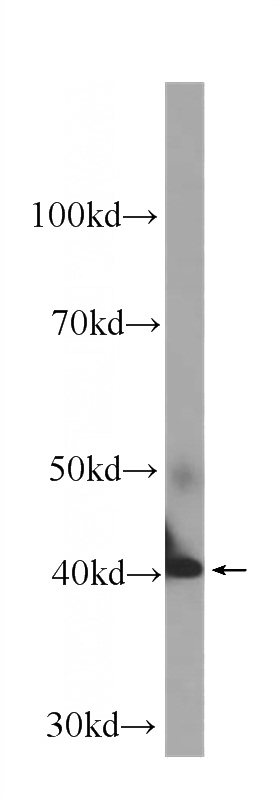 human brain tissue were subjected to SDS PAGE followed by western blot with Catalog No:107304(GOT1 Antibody) at dilution of 1:1000