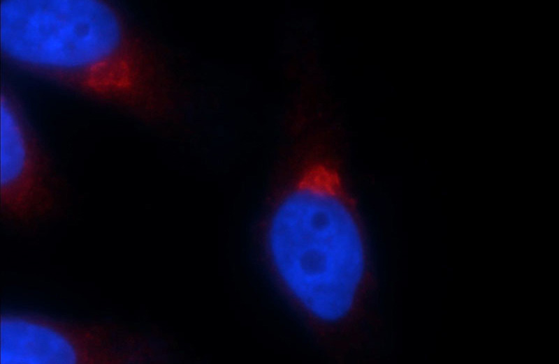 Immunofluorescent analysis of HepG2 cells using Catalog No:111049(GOSR2 Antibody) at dilution of 1:25 and Rhodamine-Goat anti-Rabbit IgG