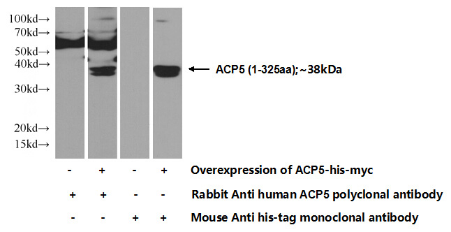 Transfected HEK-293 cells were subjected to SDS PAGE followed by western blot with Catalog No:107690(ACP5 Antibody) at dilution of 1:500