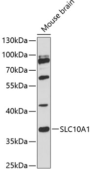 Western blot - SLC10A1 Polyclonal Antibody 