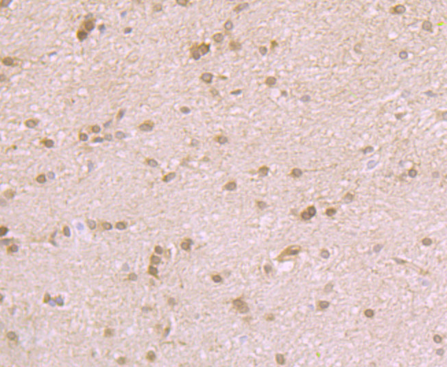 Fig5: Immunohistochemical analysis of paraffin-embedded rat brain tissue using anti-Nesprin 1 antibody. Counter stained with hematoxylin.