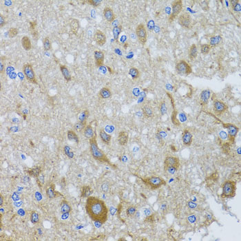Immunohistochemistry - DYNC1I1 Polyclonal Antibody 