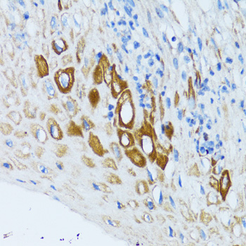 Immunohistochemistry - PSRC1 Polyclonal Antibody 