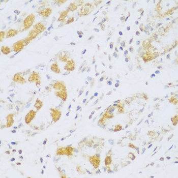 Immunohistochemistry - FDXR Polyclonal Antibody 
