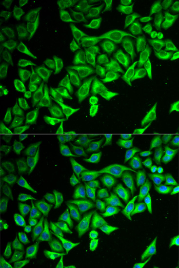 Immunofluorescence - DAP Polyclonal Antibody 