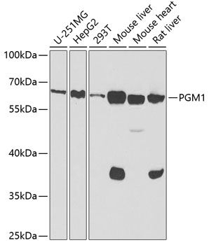 Western blot - PGM1 Polyclonal Antibody 