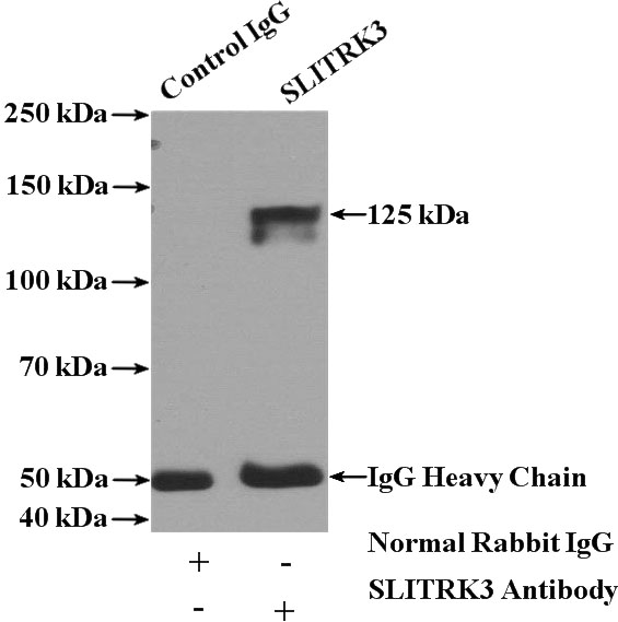IP Result of anti-SLITRK3 (IP:Catalog No:115358, 4ug; Detection:Catalog No:115358 1:300) with mouse brain tissue lysate 4000ug.