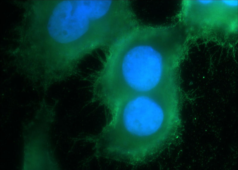 Immunofluorescent analysis of HeLa cells using Catalog No:114647(RGS4 Antibody) at dilution of 1:50 and Alexa Fluor 488-congugated AffiniPure Goat Anti-Rabbit IgG(H+L)