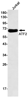 Western blot detection of ATF2 in Jurkat cell lysates using ATF2 Rabbit pAb(1:500 diluted).Predicted band size:55kDa.Observed band size:70kDa.