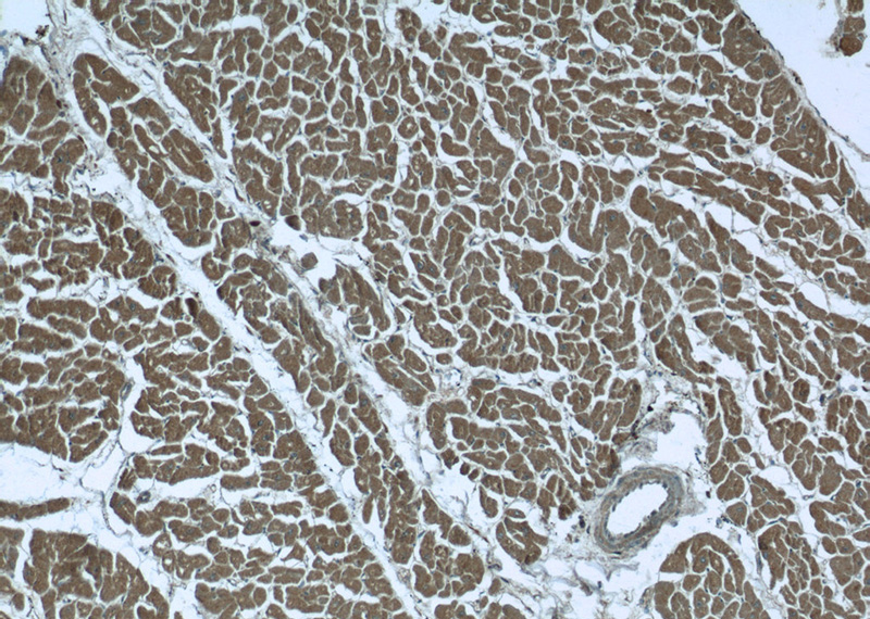 Immunohistochemistry of paraffin-embedded human heart tissue slide using Catalog No:111756(ILVBL Antibody) at dilution of 1:100 (under 10x lens)