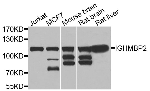 Western blot - IGHMBP2 Polyclonal Antibody 