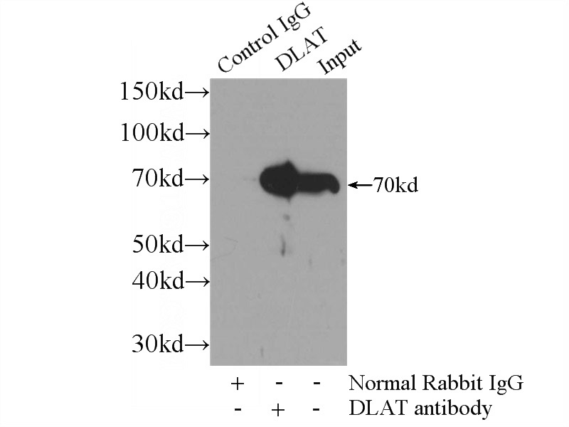 IP Result of anti-DLAT (IP:Catalog No:109985, 3ug; Detection:Catalog No:109985 1:1000) with HepG2 cells lysate 2000ug.