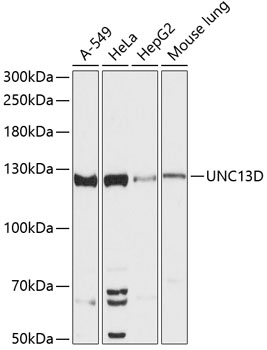 Western blot - UNC13D Polyclonal Antibody 