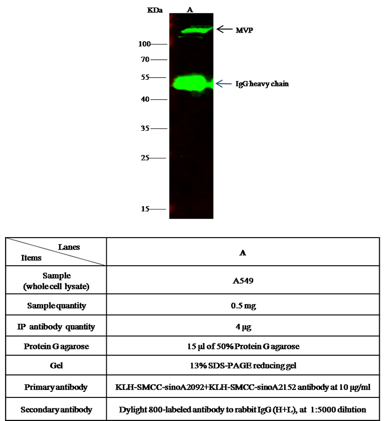Human MVP/major vault protein Immunoprecipitation(IP) 15592