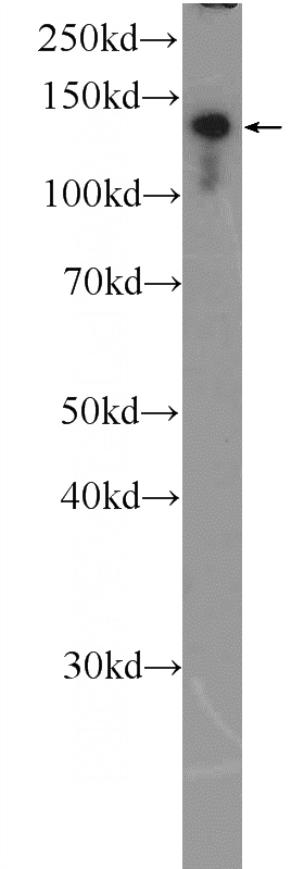 HeLa cells were subjected to SDS PAGE followed by western blot with Catalog No:109249(CEBPZ Antibody) at dilution of 1:3000