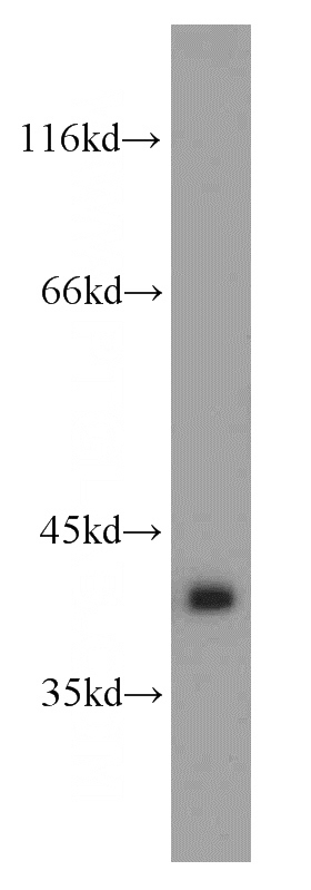 mouse eye tissue were subjected to SDS PAGE followed by western blot with Catalog No:110993(GNAT1 antibody) at dilution of 1:300